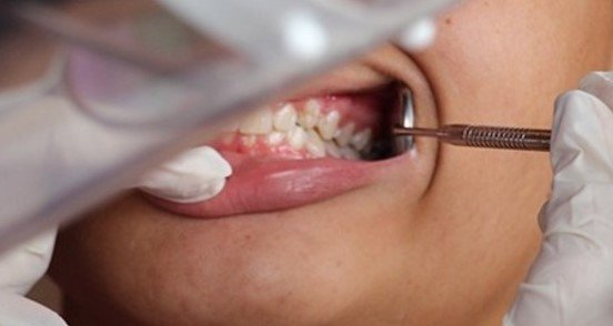 Leia mais sobre o artigo Minas Gerais investe na saúde bucal da população
